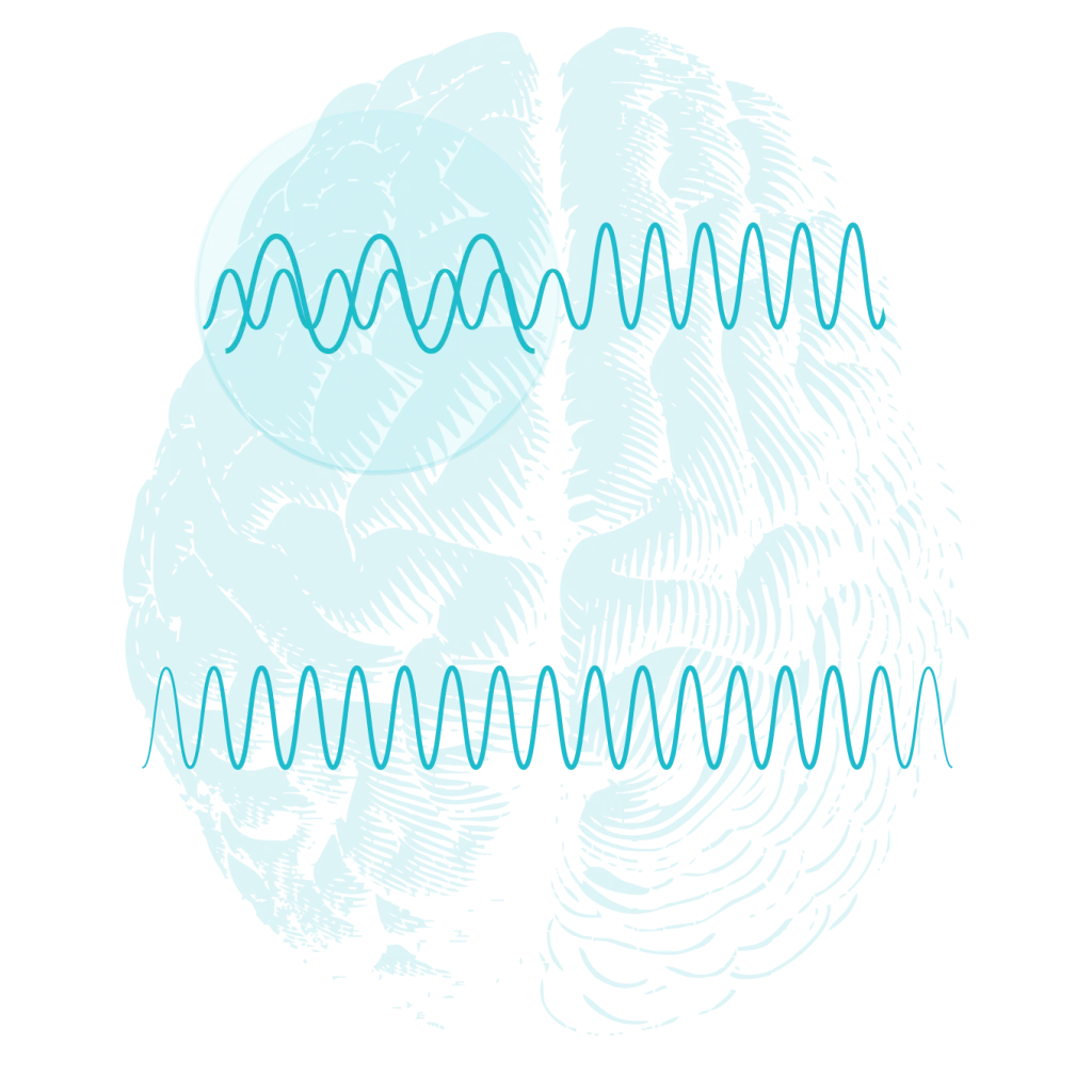 Brain wave patterns for ADHD treatment