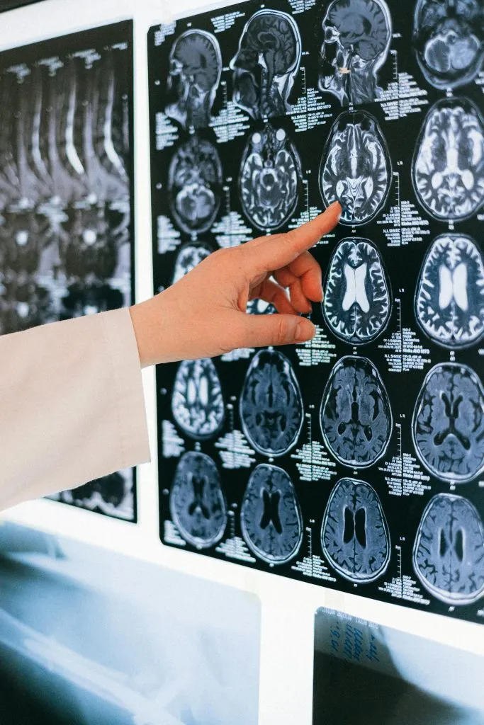 MeRT for Traumatic Brain Injury (TBI)