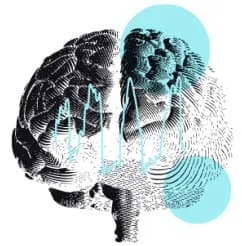 Brain scan 3